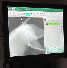 Pantalla mostrando una placa de rayos x